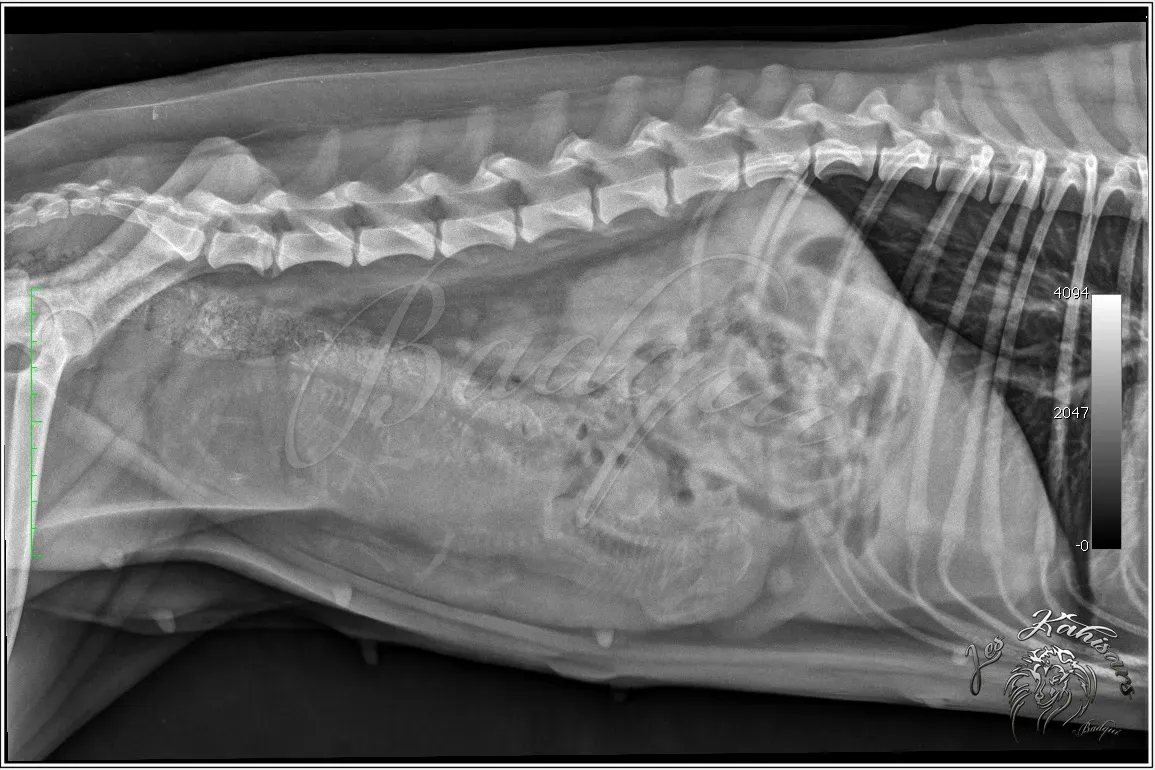 Radiographie de gestation